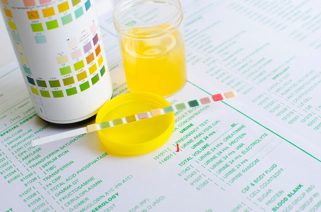 Urine Analysis Testing